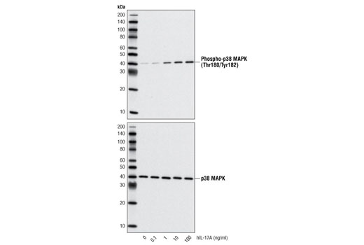 Human Interleukin-17A (hIL-17A) - 10 ug