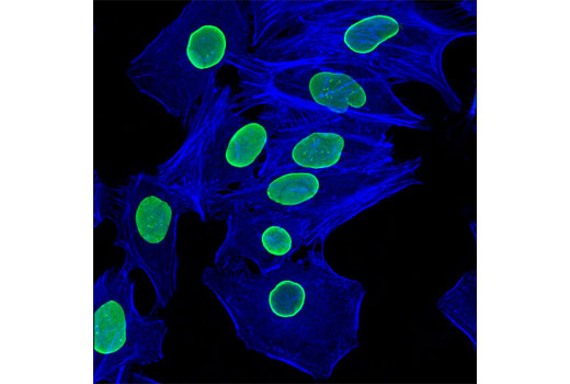 Alexa Fluor® 647 Phalloidin - 300 assays