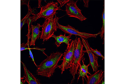 Alexa Fluor® 555 Phalloidin - 300 assays