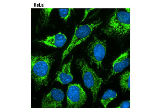 ProLong® Gold Antifade Reagent with DAPI - 10 ml