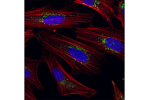 Rag and LAMTOR Antibody Sampler Kit - 1 Kit