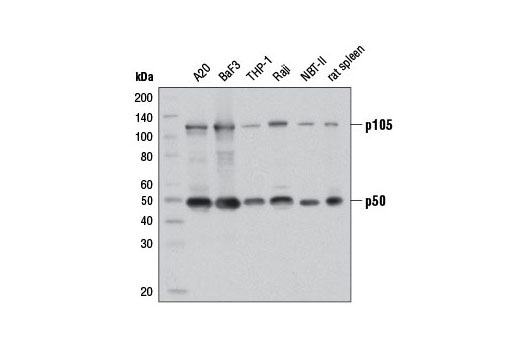 Huntingtin Interaction Antibody Sampler Kit - 1 Kit