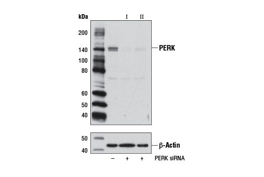 SignalSilence® PERK siRNA I - 300 ul