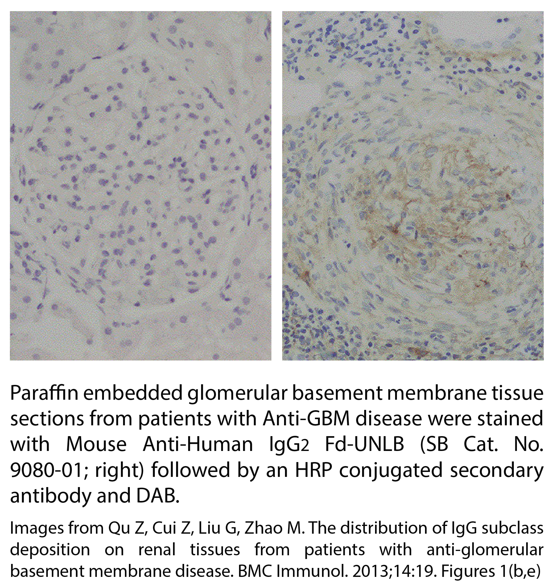 Mouse Anti-Human IgG2 Fd-UNLB - 0.5 mg