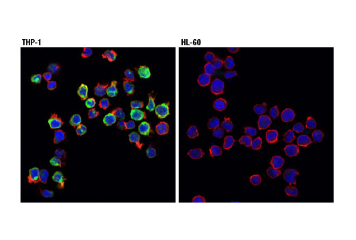 TREM2 Signaling Pathways Antibody Sampler Kit - 1 Kit