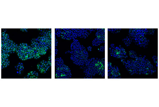 CDK Antibody Sampler Kit - 1 Kit