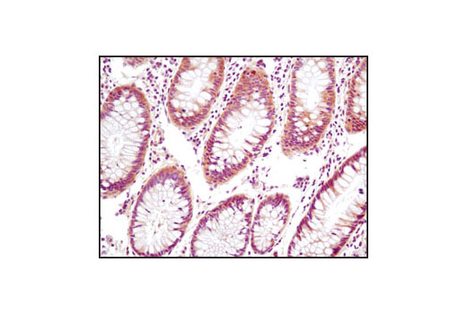 PTEN and PDK1 Antibody Sampler Kit II - 1 Kit