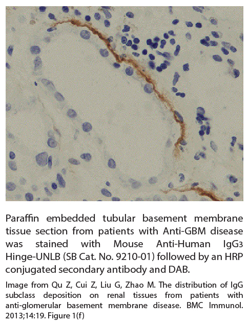 Mouse Anti-Human IgG3 Hinge-UNLB - 0.5 mg