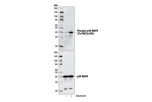 p38 MAPK Control Cell Extracts - 150 ul