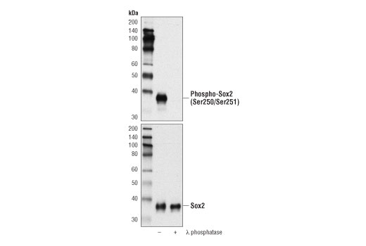 PhosphoPlus® Sox2 (Ser250/Ser251) Antibody Duet - 1 Kit