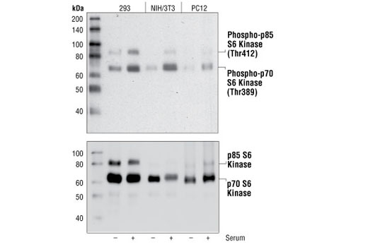 PhosphoPlus® p70 S6 Kinase (Thr389) Antibody Duet - 1 Kit