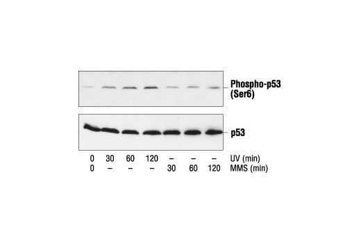 Phospho-p53 Antibody Sampler Kit - 1 Kit