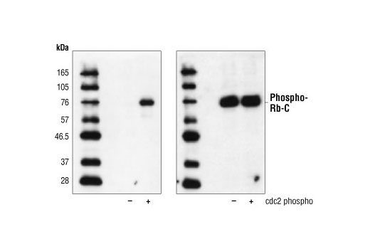 Rb Control Proteins - 10 western blots