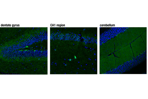 Cannabinoid Receptor 1 Downstream Signaling Antibody Sampler Kit - 1 Kit