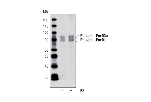 Forkhead Signaling Antibody Sampler Kit - 1 Kit