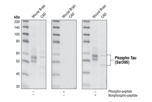 PhosphoPlus® Tau (Ser396) Antibody Duet - 1 Kit