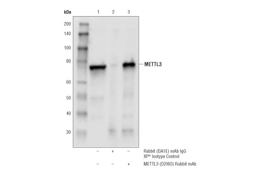 N6-mA Methyltransferase Antibody Sampler Kit - 1 Kit