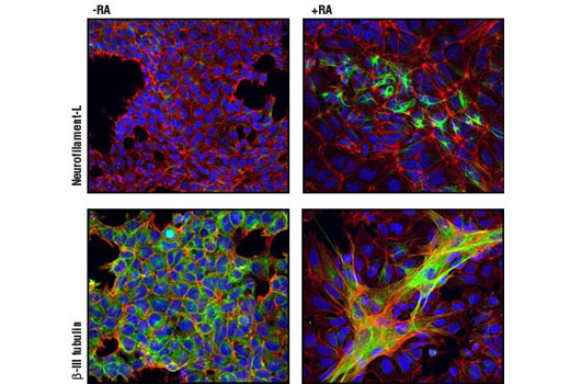 StemLight™ Pluripotency Antibody Kit - 1 Kit