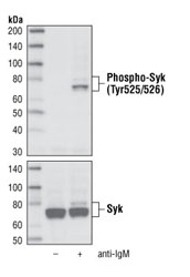 B Cell Signaling Antibody Sampler Kit - 1 Kit