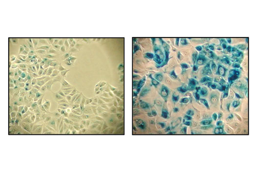 Senescence β-Galactosidase Staining Kit - 1 Kit