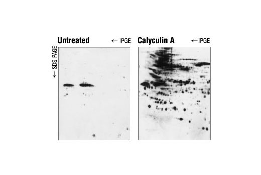 Calyculin A - 10 ug