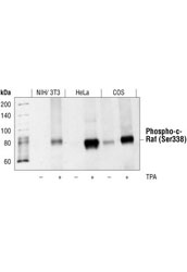 Phospho-Erk1/2 Pathway Antibody Sampler Kit - 1 Kit