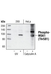 Phospho-p38 MAPK Pathway Antibody Sampler Kit - 1 Kit