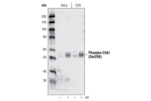 Phospho-Chk1/2 Antibody Sampler Kit - 1 Kit